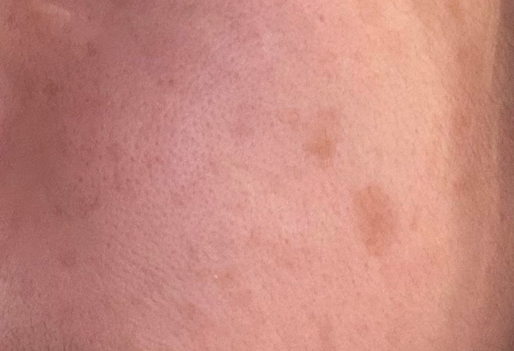 メラノショット W/ONE BY KOSE/美容液を使ったクチコミ(6枚目)