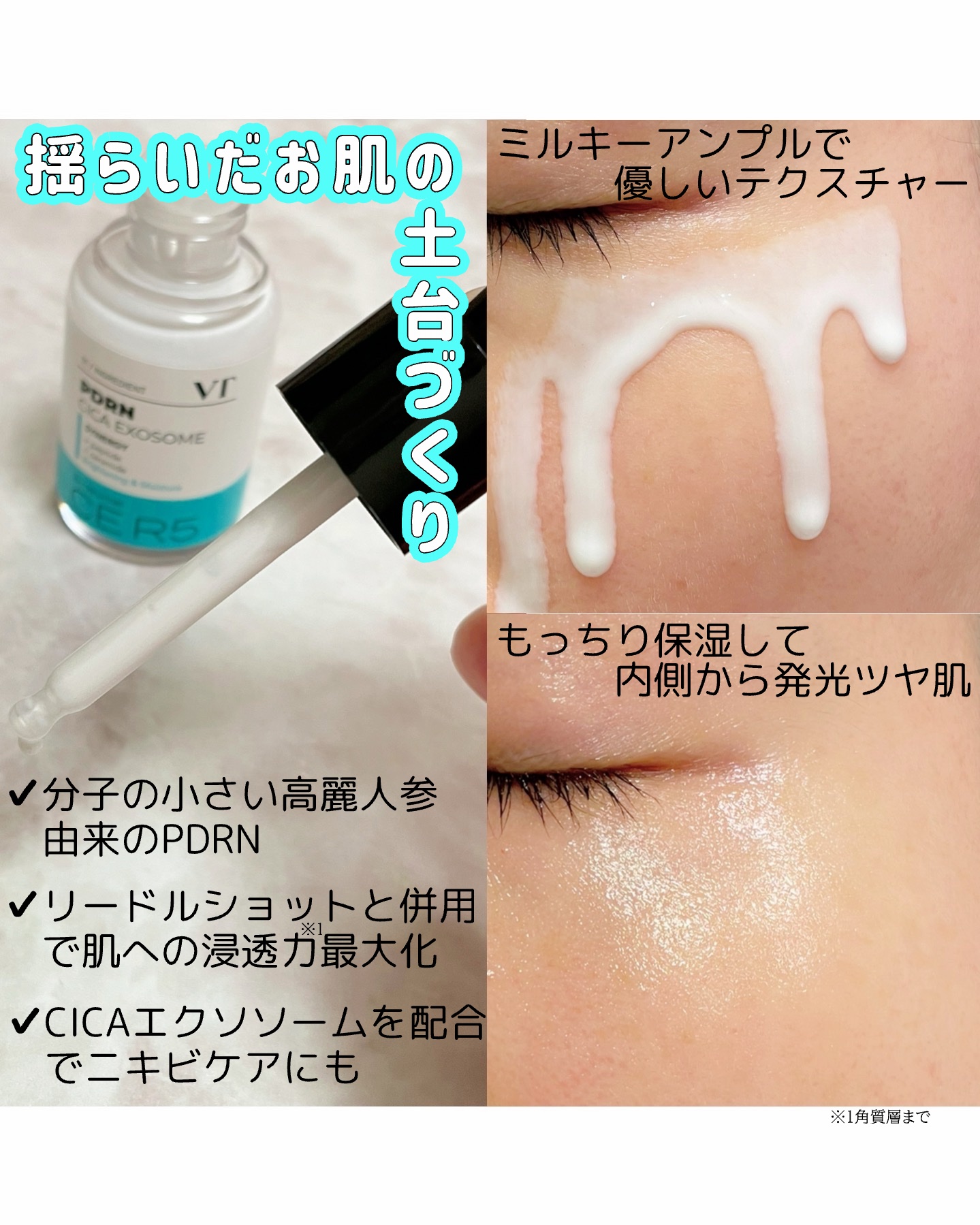 リードルショット300/VT/美容液を使ったクチコミ（3枚目）