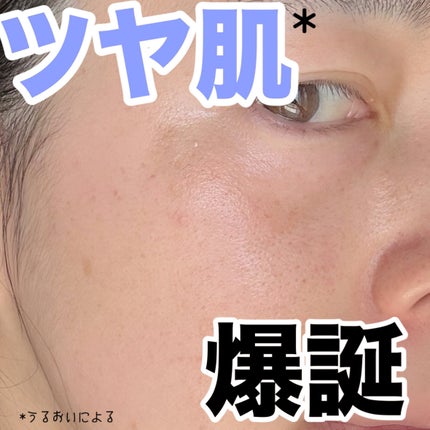 リードルショット300/VT/美容液を使ったクチコミ(4枚目)