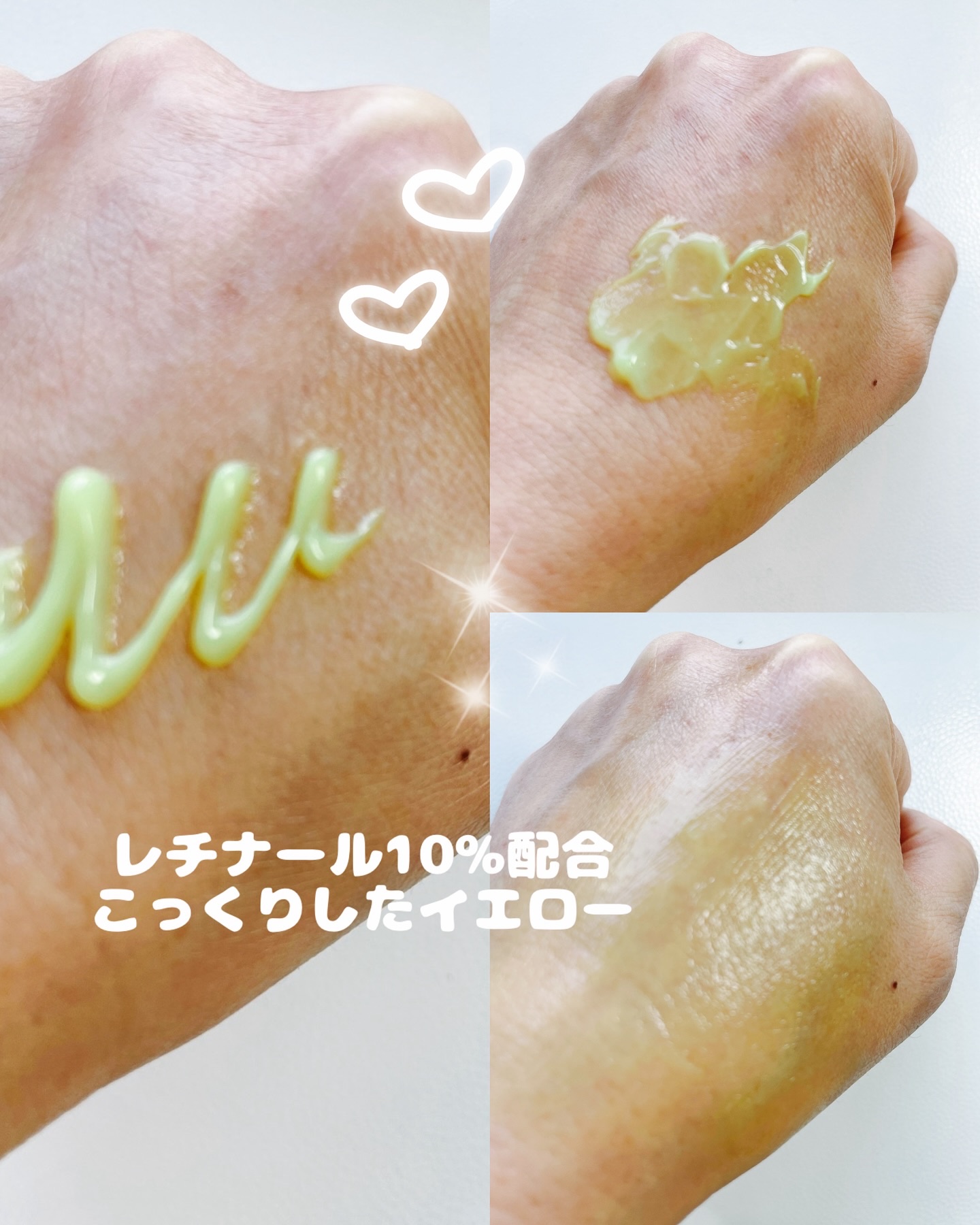 VITALIFT A/Dr.Different/フェイスクリームを使ったクチコミ（3枚目）