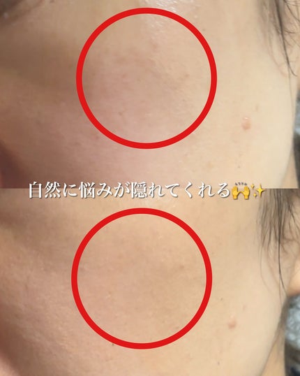 まるみ♡ on LIPS 「THETOOLLAB🤍スキンフィットコンシールデュオ🤍こんなの..」(6枚目)