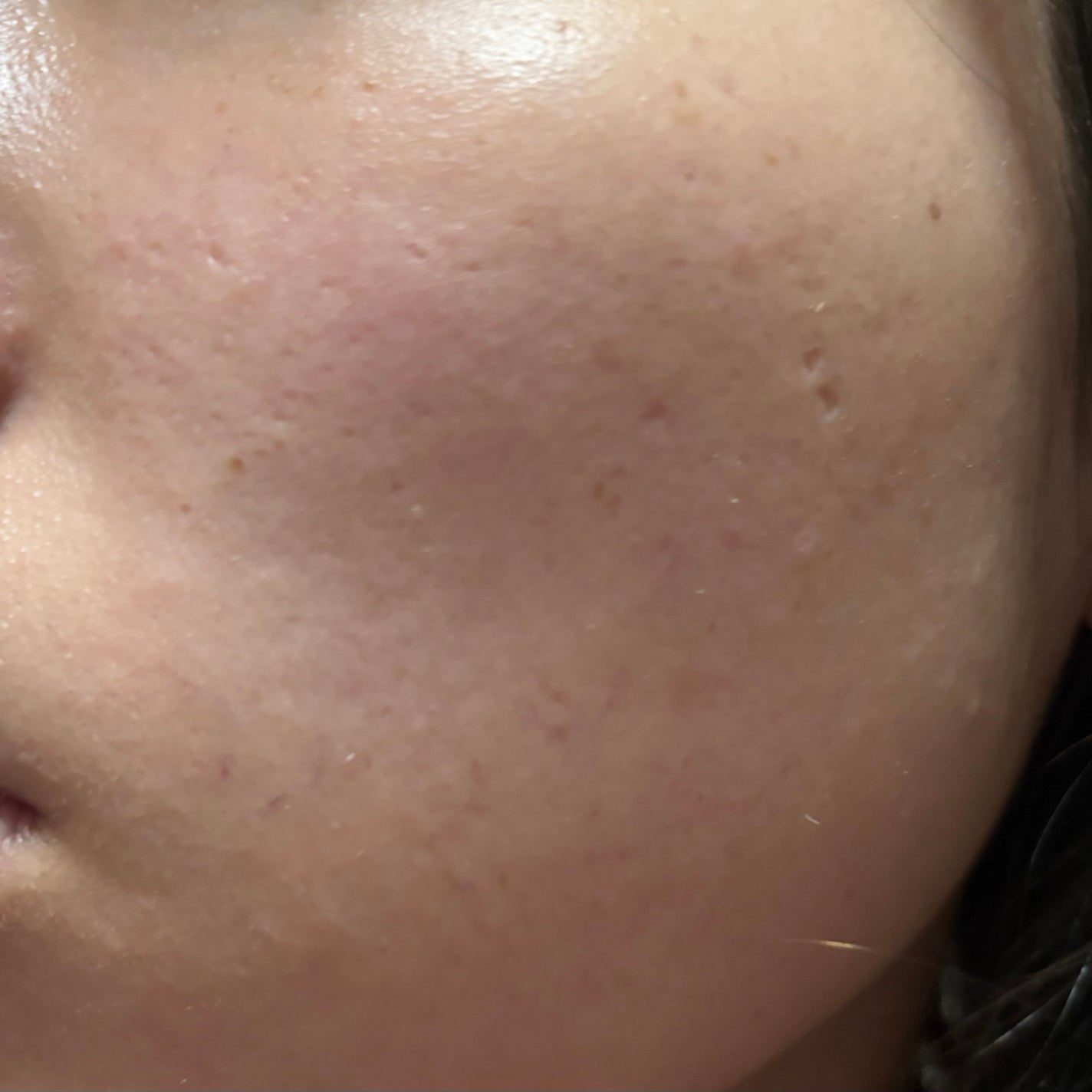 Honoka on LIPS 「🙇♀️スキンケアに詳しい方教えてください🙇♀️私の肌に合う..」(3枚目)