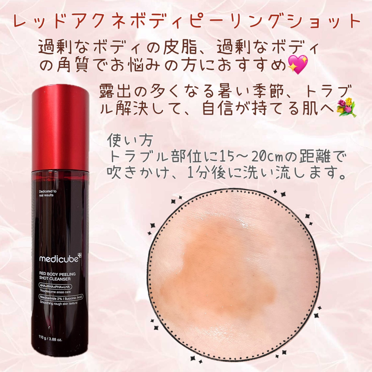 レッドアクネ ボディピーリングショット/MEDICUBE/ピーリングを使ったクチコミ(1枚目)