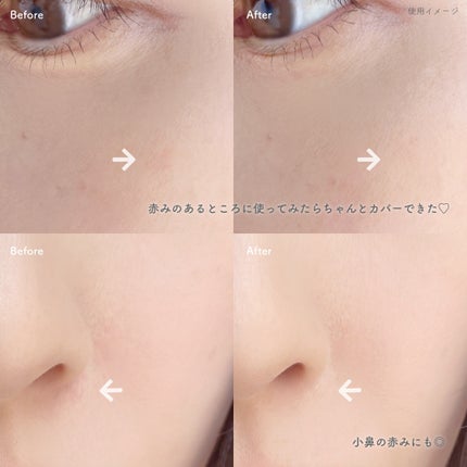 薬用コンシーラー アクネプロテクター/ONLY MINERALS/パウダーコンシーラーを使ったクチコミ(4枚目)