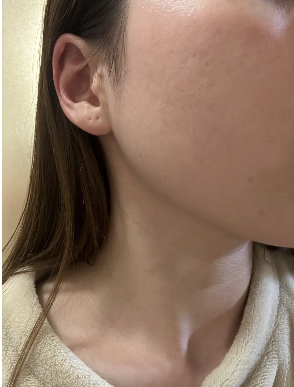 ダーマレーザー スーパーレチノール100マスク/クオリティファースト/シートマスク・パックを使ったクチコミ（1枚目）