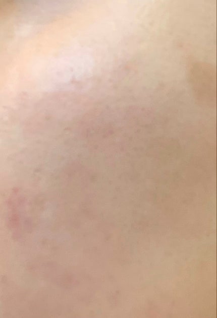 オールアバウトグロウカバークリーム/CHASIN'RABBITS/日焼け止めクリームを使ったクチコミ(3枚目)