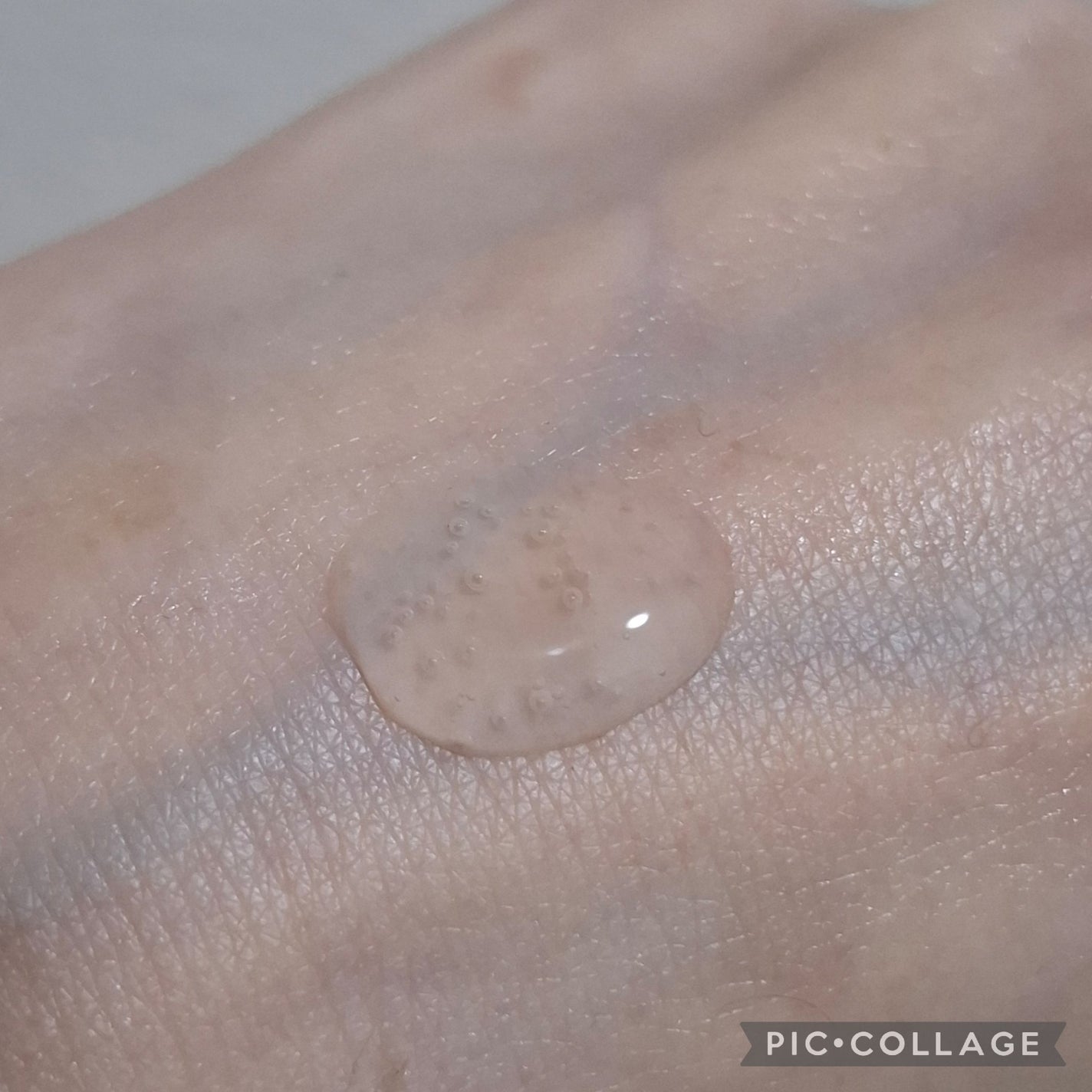 ブレミッシュケアアップ セラム/ISOI/美容液を使ったクチコミ(3枚目)