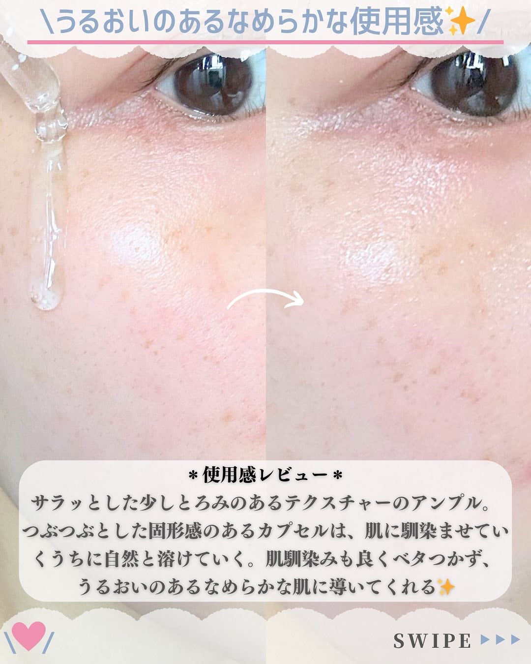 トーンブライトニング カプセルアンプル/SKIN1004/美容液を使ったクチコミ(6枚目)