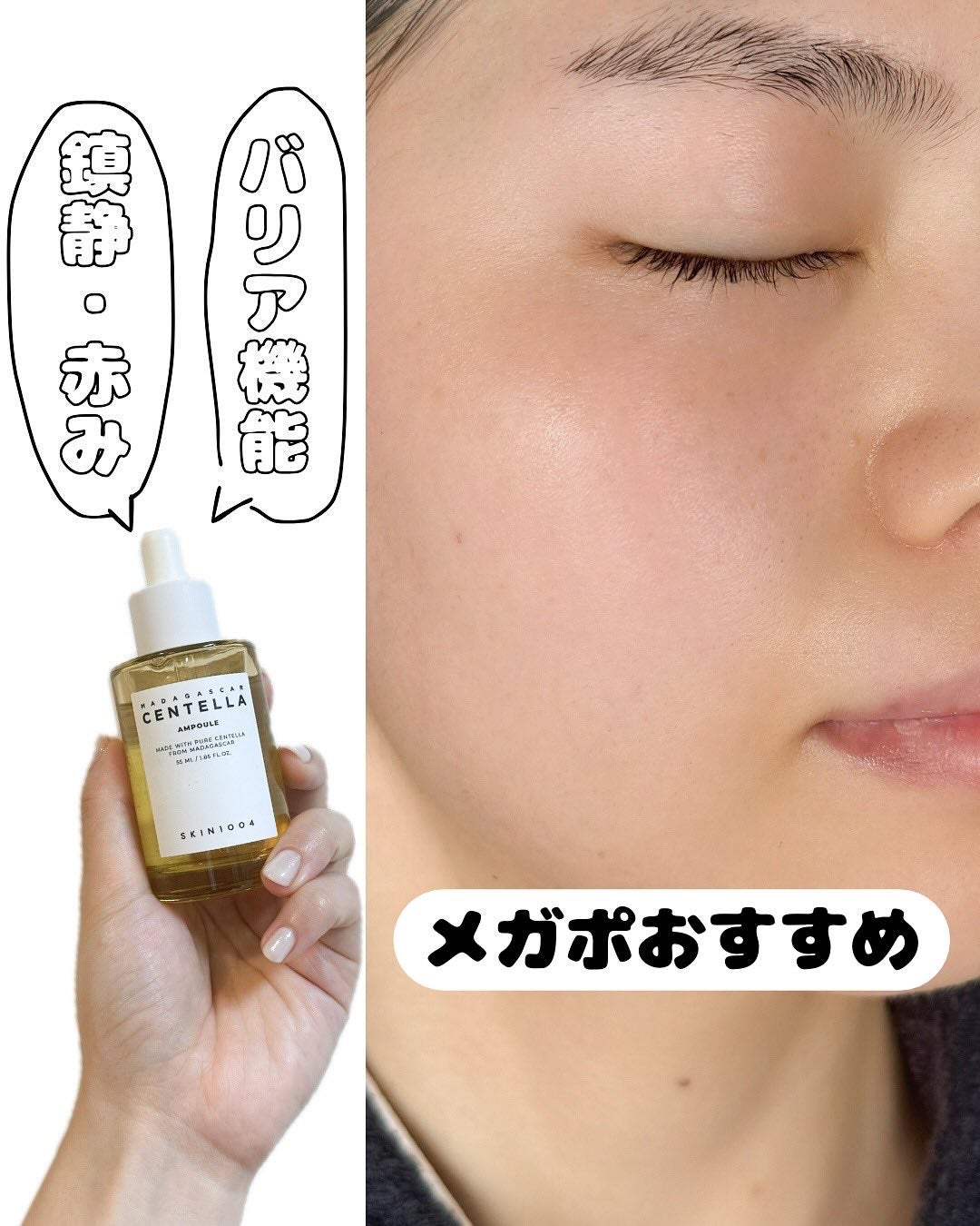 センテラ アンプル/SKIN1004/美容液を使ったクチコミ(1枚目)