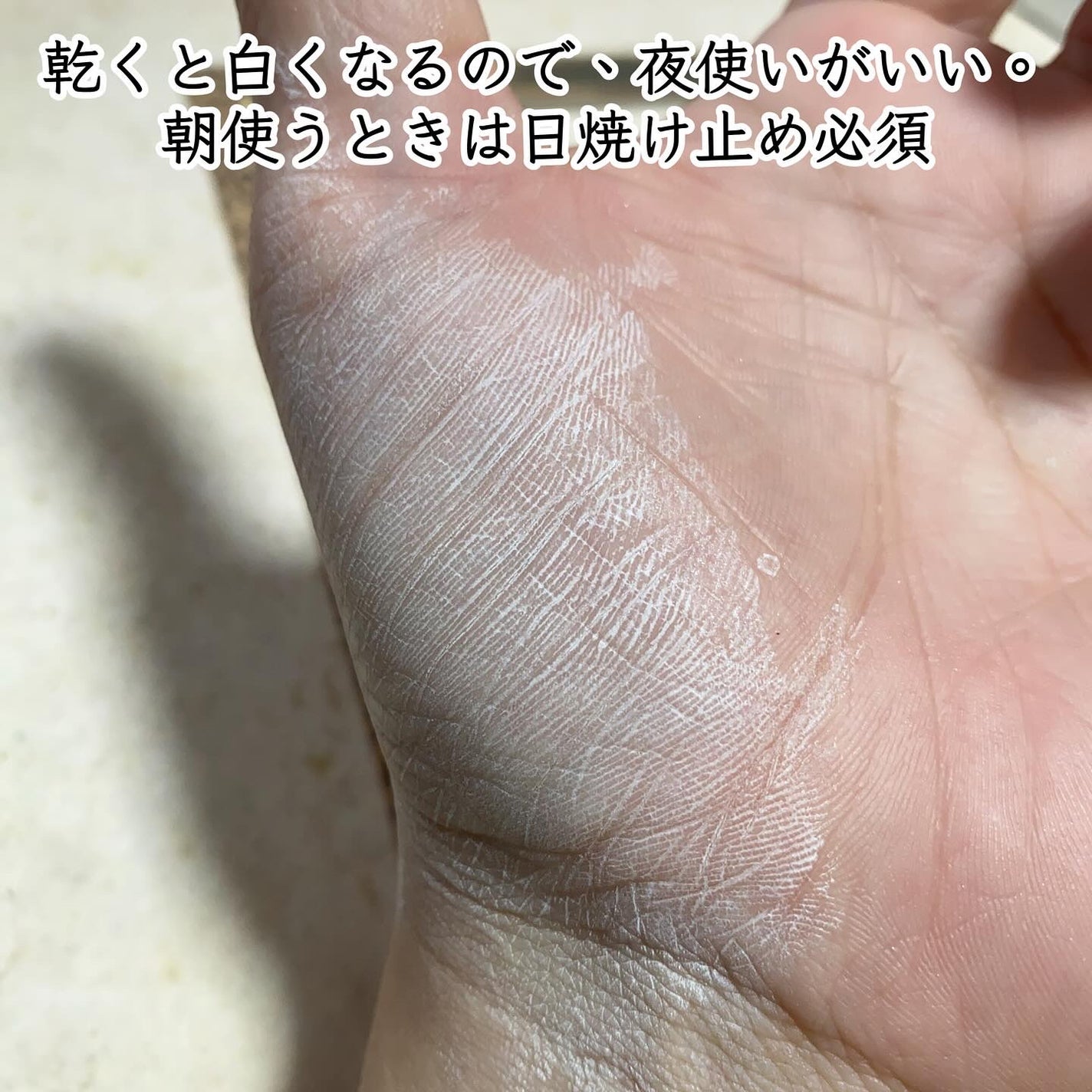 AZアゼライン酸15セラム/コスデバハ/美容液を使ったクチコミ(6枚目)