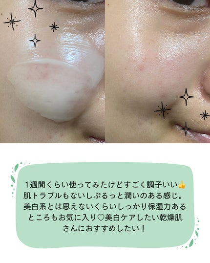 レッドブレミッシュ リペアスージングクリーム/Dr.G/フェイスクリームを使ったクチコミ(6枚目)