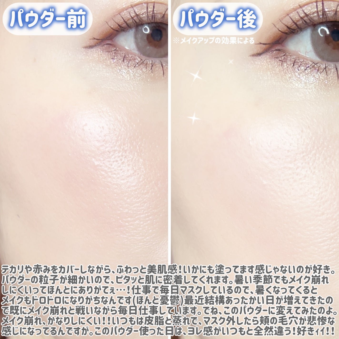 +By lilay スパイシーリッププランパー/LILAY/リッププランパーを使ったクチコミ(5枚目)