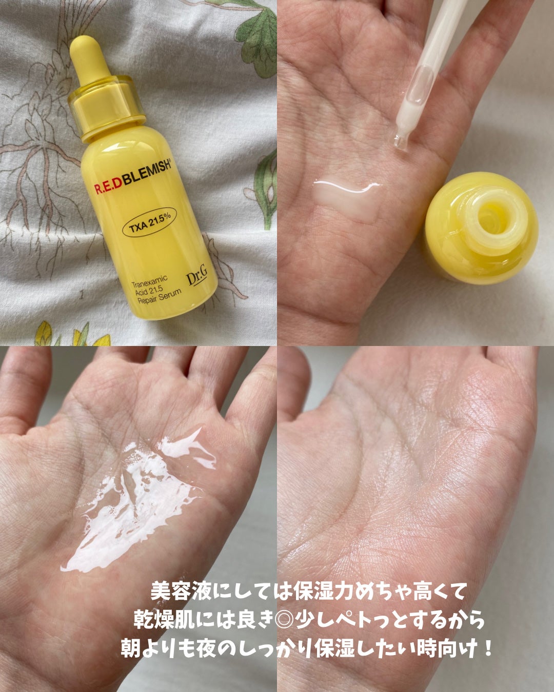 レッドブレミッシュ リペアスージングクリーム/Dr.G/フェイスクリームを使ったクチコミ(3枚目)