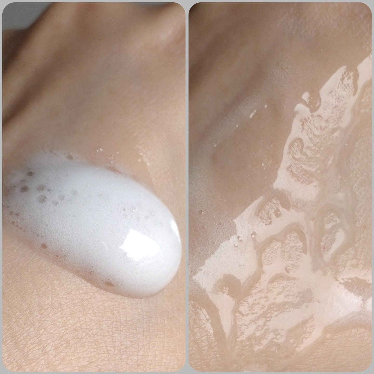 ソフィーナ iP 水光ピーリング泡セラム<ふきとり美容液>/SOFINA iP/美容液を使ったクチコミ（2枚目）