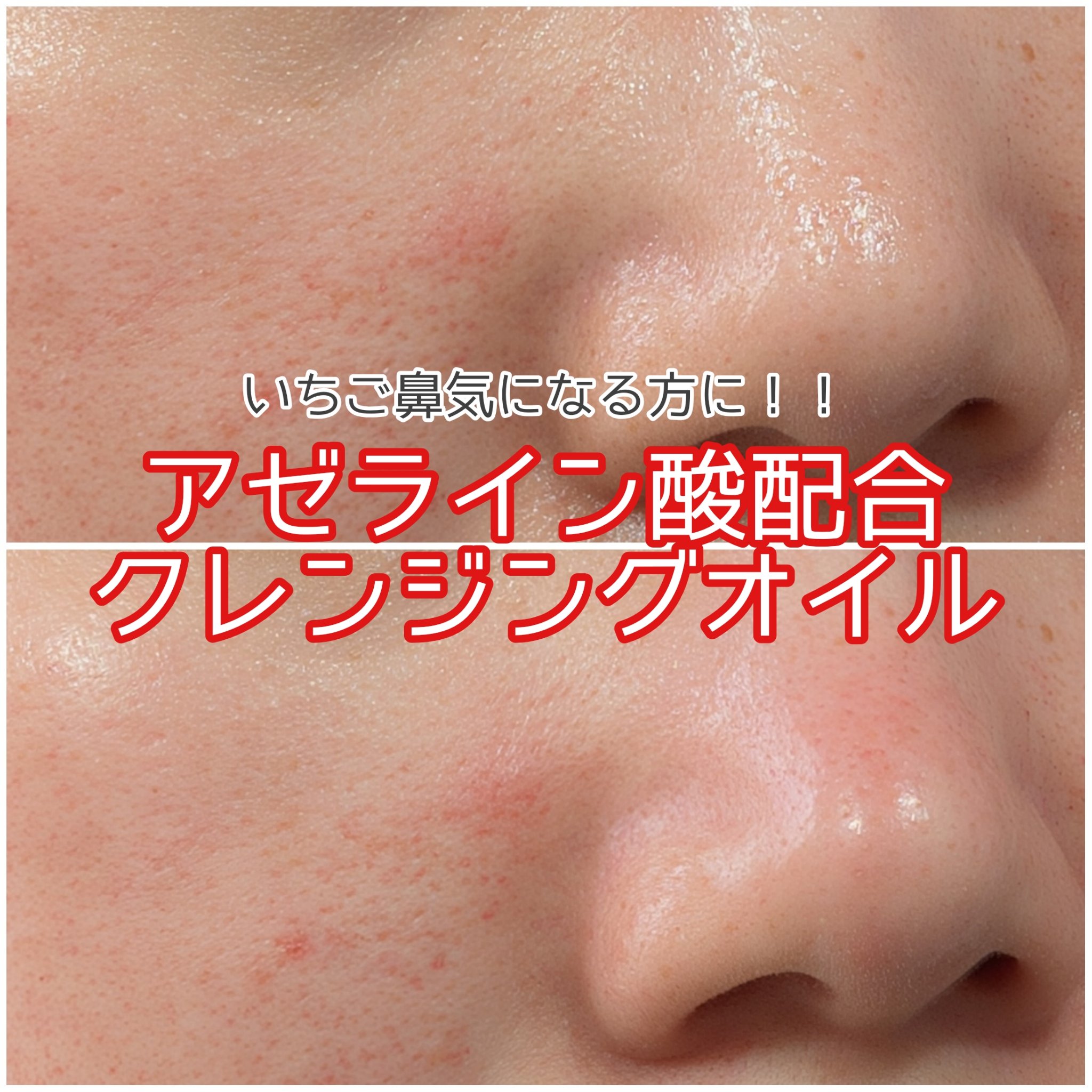 AZケア クレンジングオイル/VT/オイルクレンジングを使ったクチコミ（1枚目）