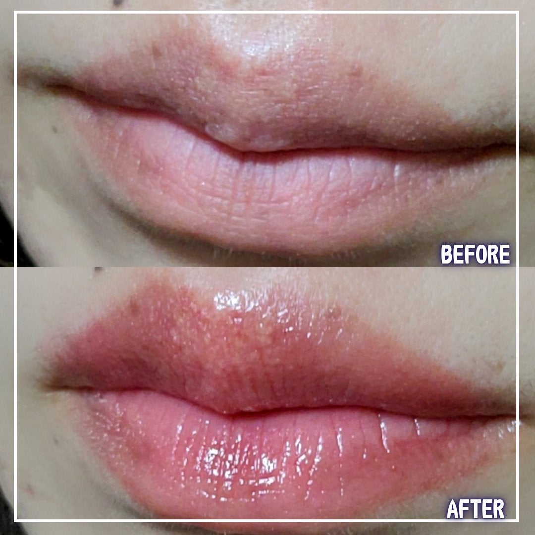 ボリュームリッププランパー/BANILA CO/リッププランパーを使ったクチコミ(2枚目)