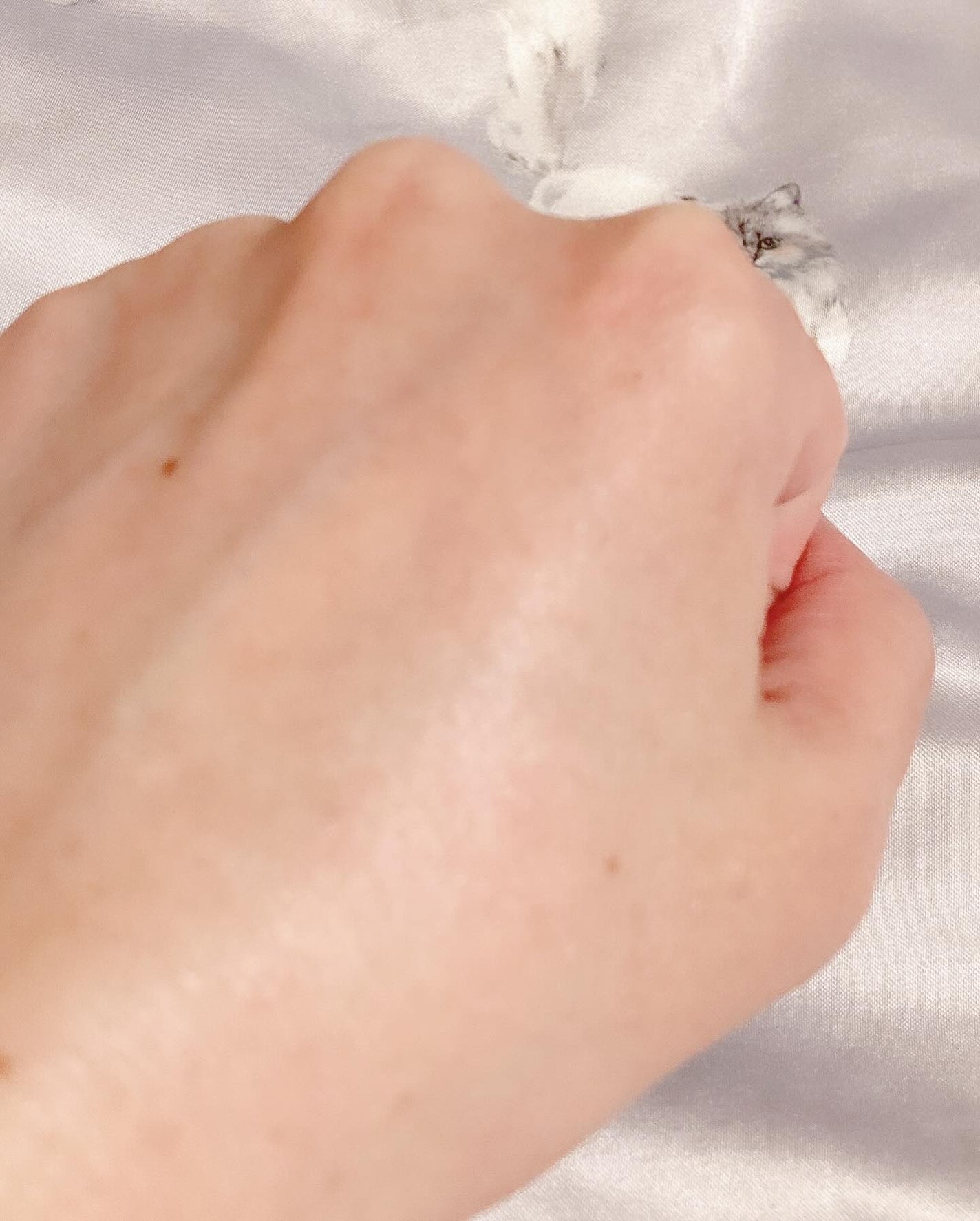 TXアンプルRX+TXクリーム/Dr.Melaxin/スキンケアキットを使ったクチコミ(9枚目)