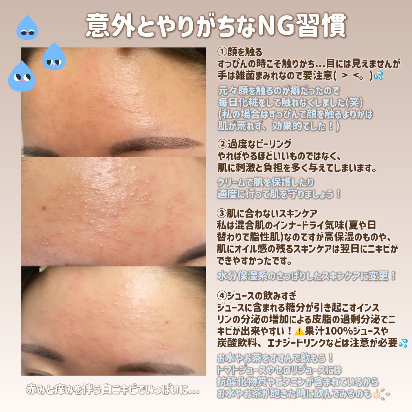 レチノール シカ リペア セラム/innisfree/美容液を使ったクチコミ(2枚目)