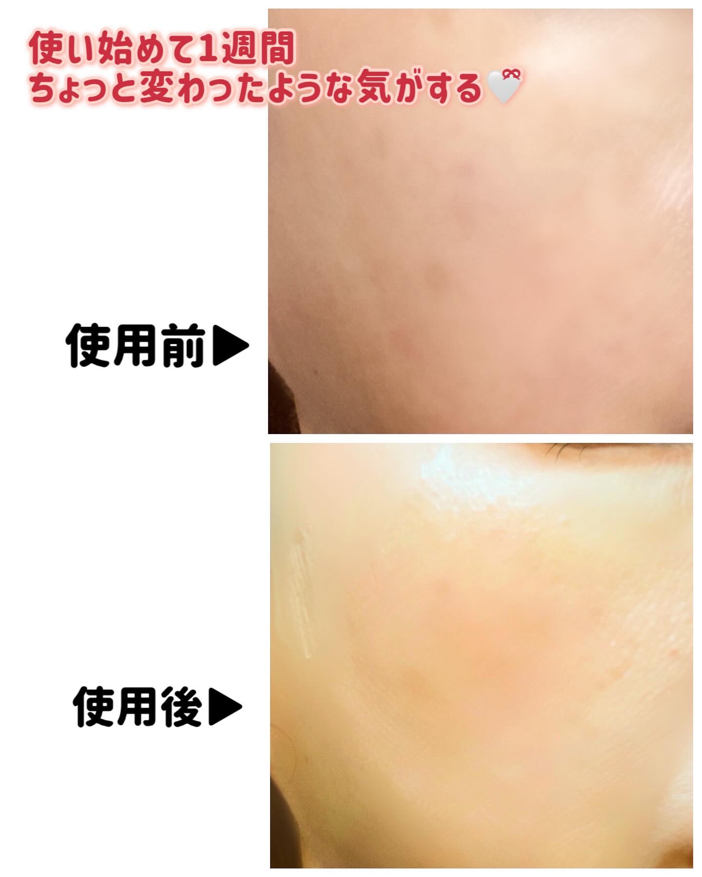 アルブチン スキンブースター セラム/MEDITHERAPY/美容液を使ったクチコミ（3枚目）