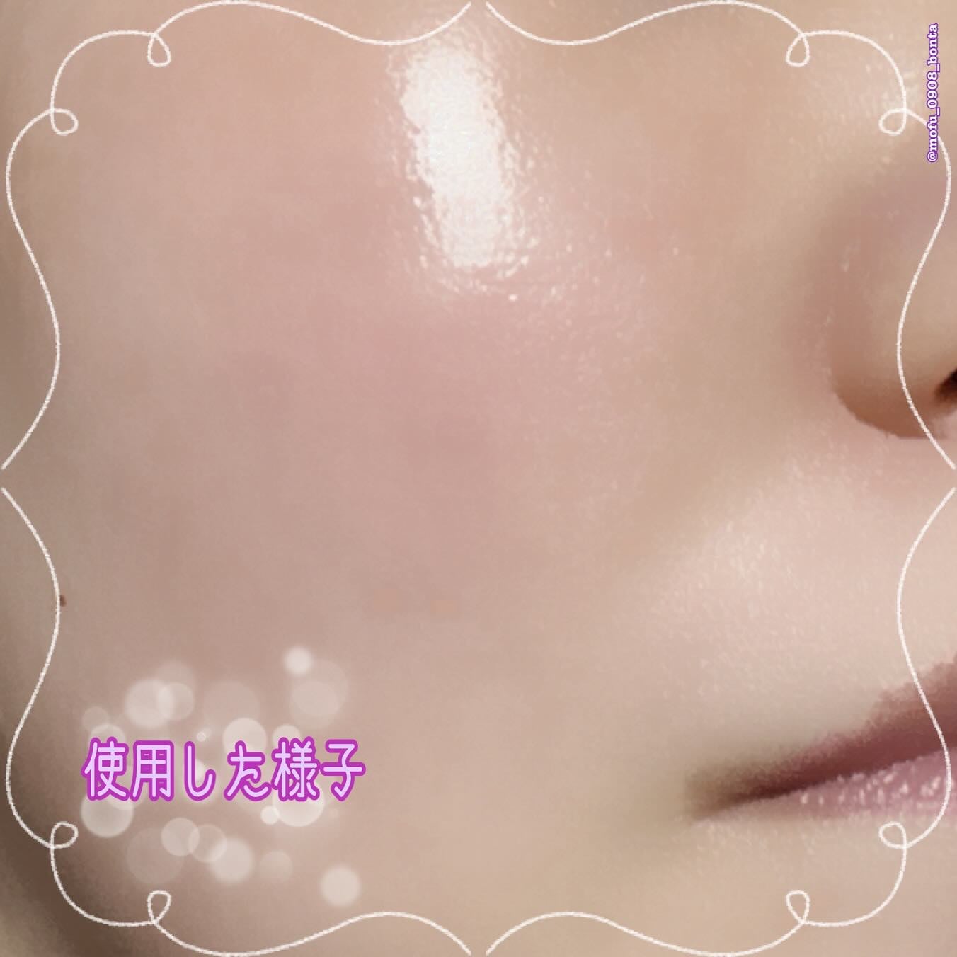 ブラックライスプロバイオティクスバリアエッセンス /haruharu wonder/美容液を使ったクチコミ(7枚目)