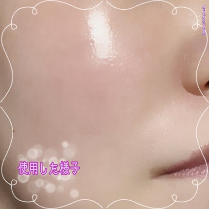 ブラックライスプロバイオティクスバリアエッセンス /haruharu wonder/美容液を使ったクチコミ(7枚目)