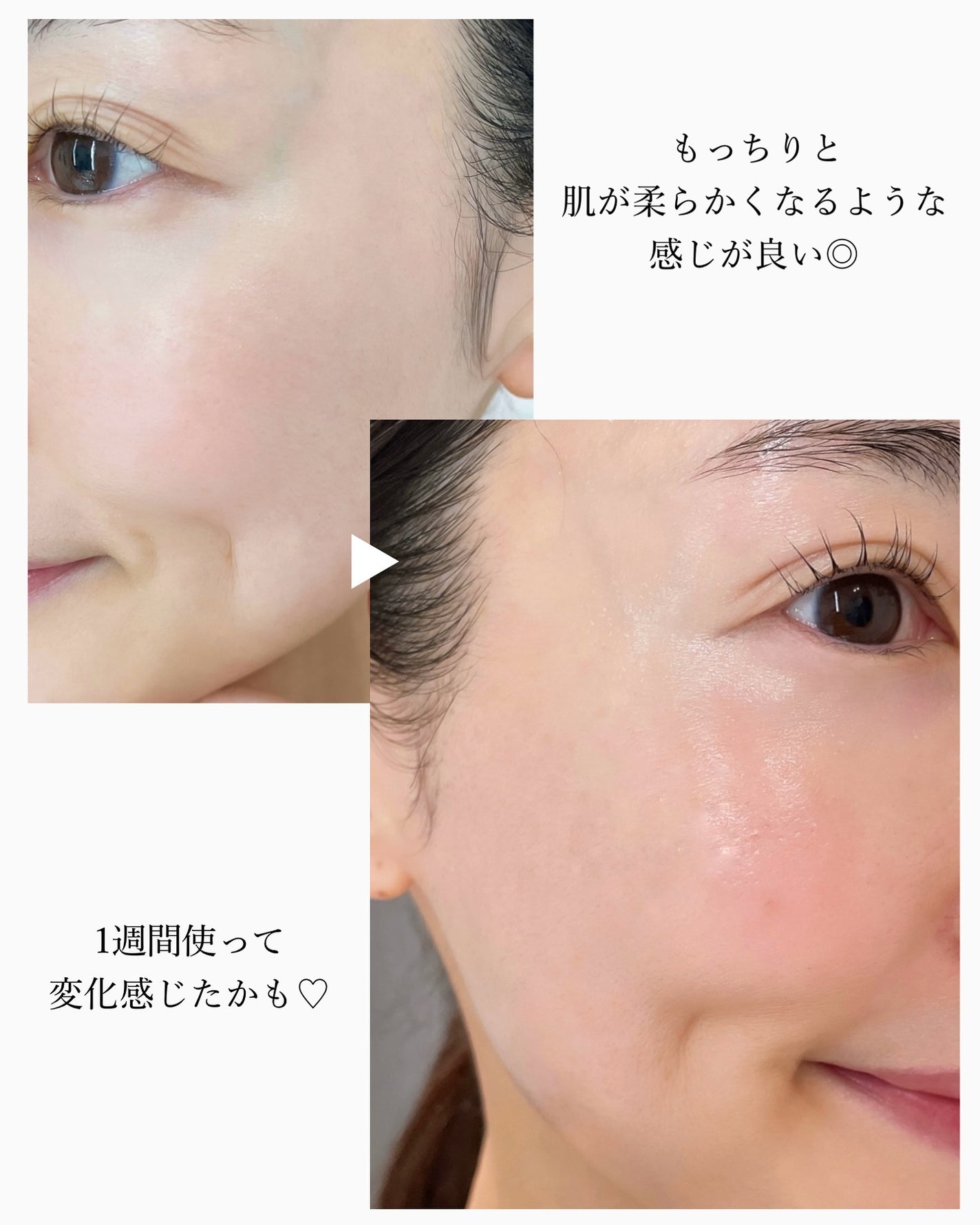 アルブチン スキンブースター セラム/MEDITHERAPY/美容液を使ったクチコミ(3枚目)