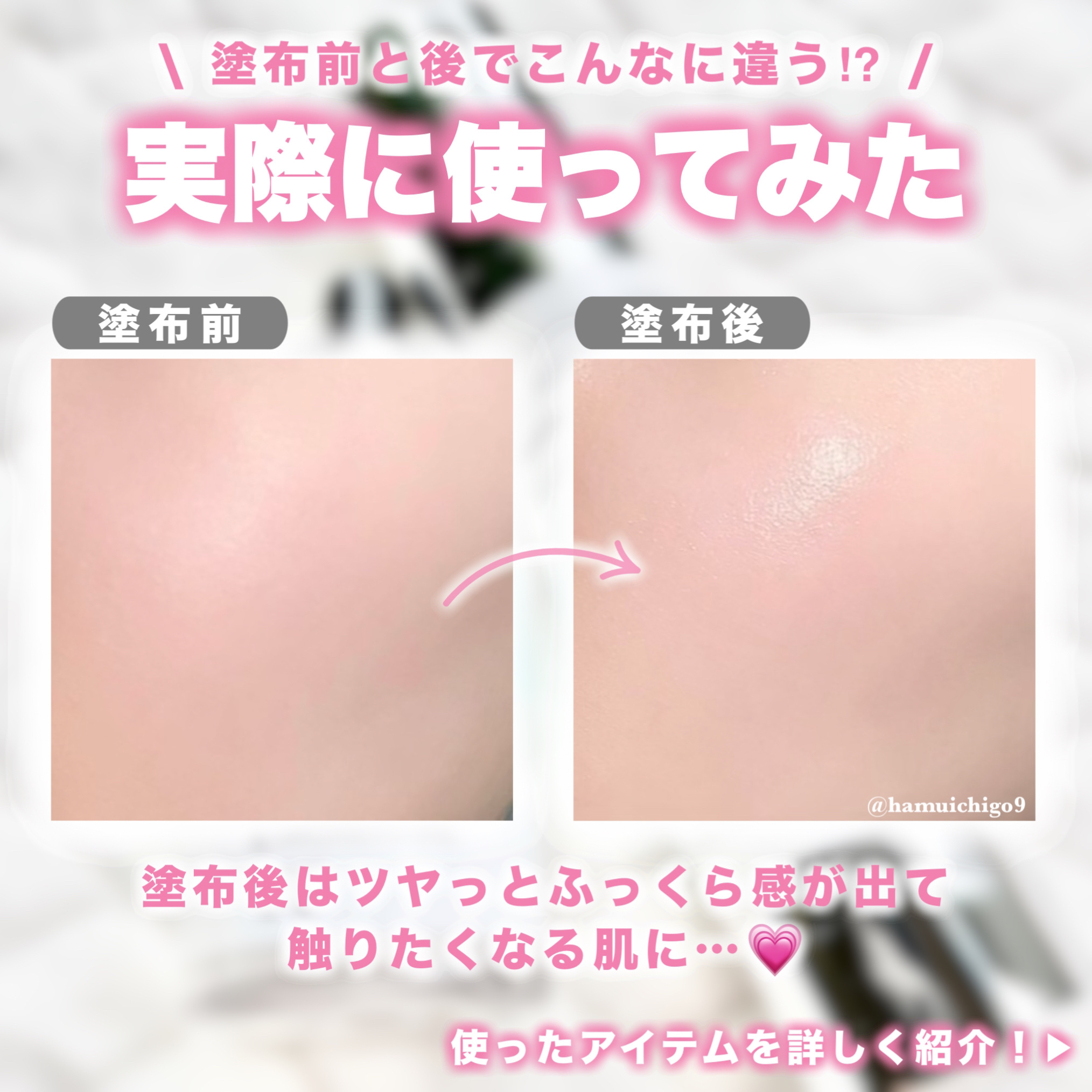 リードルショット300/VT/美容液を使ったクチコミ（3枚目）