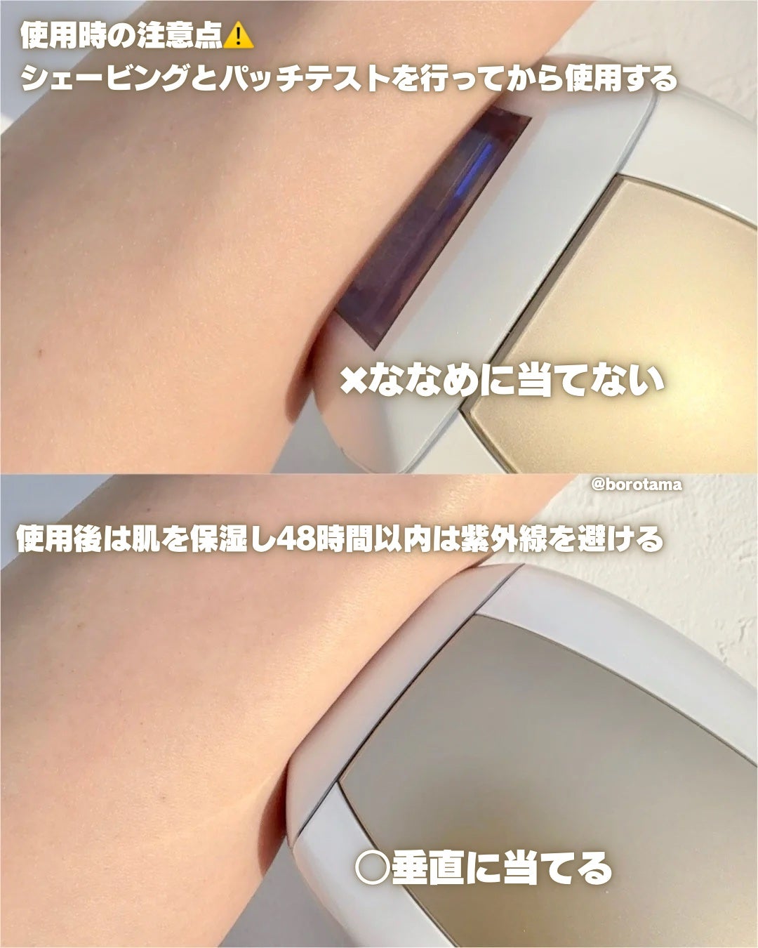 Air 10 IPL光美容器/ulike/家庭用脱毛器を使ったクチコミ(10枚目)