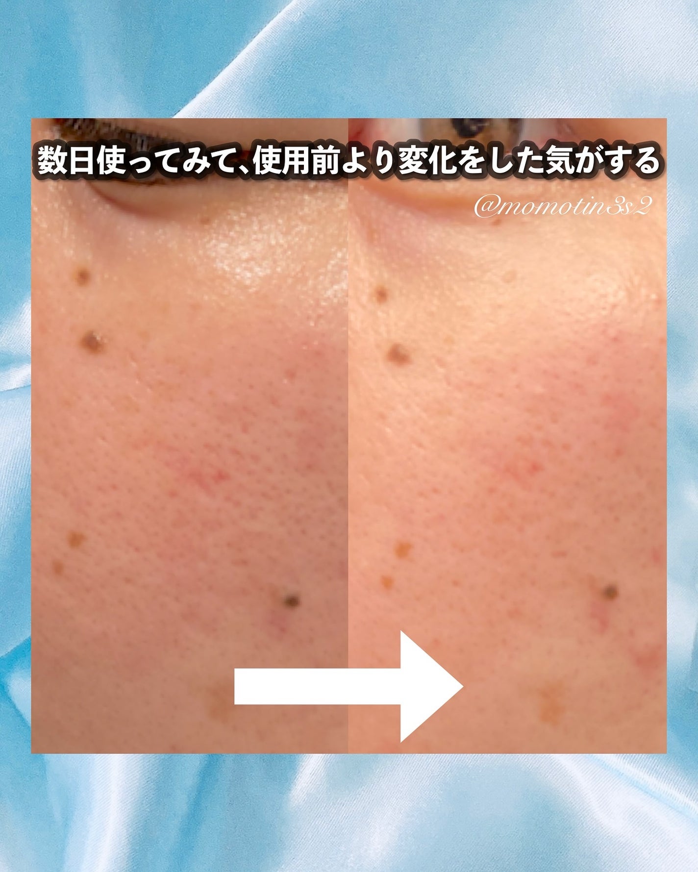 ããððð on LIPS ã#PRã#ã¡ãã£ãã©ããŒãæ¯æ¥ããã³ãã¡ããšããŠåºãã¡ãã£ãã©..ãïŒ3æç®ïŒ