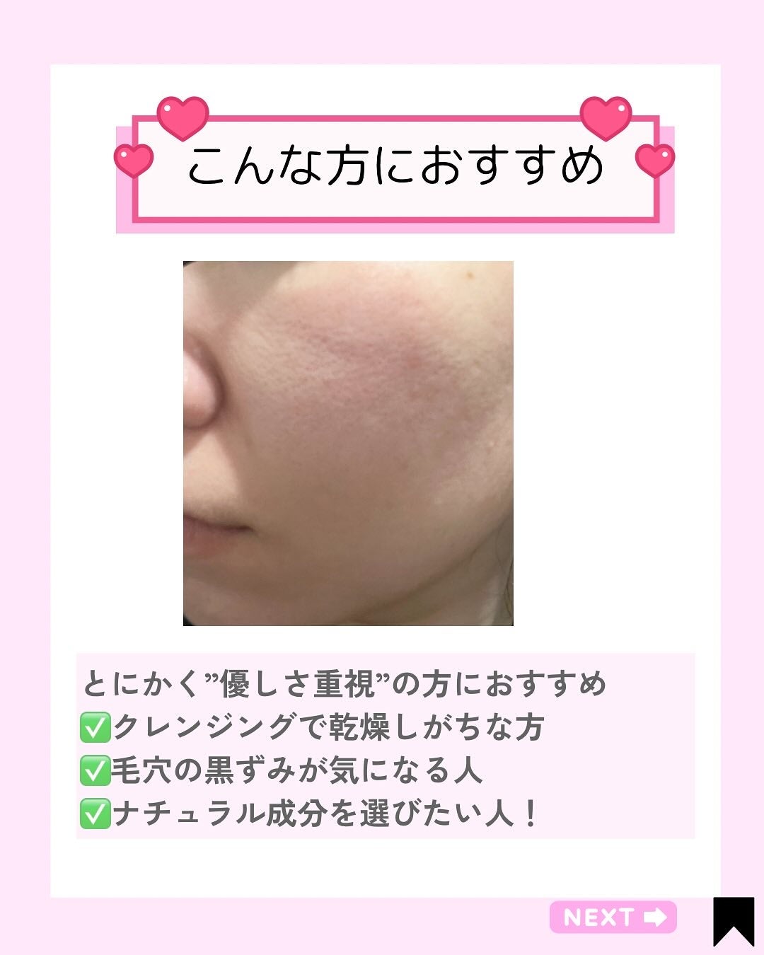 Yam Rootヴィーガンミルククレンザー/Isntree/ミルククレンジングを使ったクチコミ(4枚目)