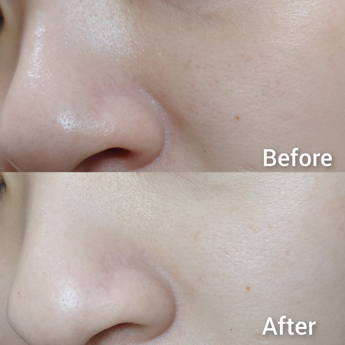 トランスルーシェント ブルーリング セッティング パウダー/PERFECT DIARY/プレストパウダーを使ったクチコミ(5枚目)