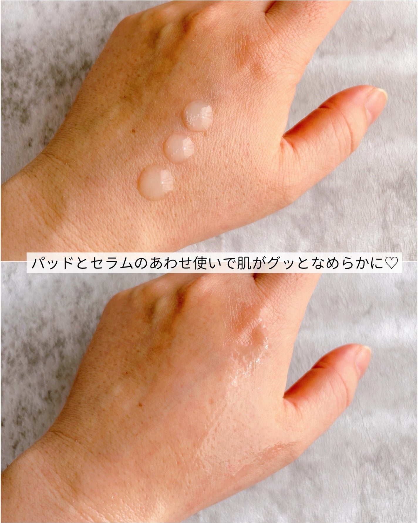 ナイアシンアミド5%パッド/SKINFOOD/その他スキンケアを使ったクチコミ(7枚目)