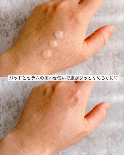 ナイアシンアミド5%パッド/SKINFOOD/その他スキンケアを使ったクチコミ(7枚目)