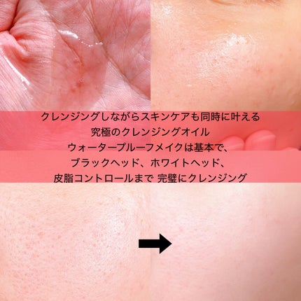 VT AZケア クレンジングオイルのクチコミ「発売3時間で売り切れ🥲💗
唯一無二!やさしく、強い!
❤︎︎︎︎┈┈┈┈┈┈┈┈┈┈┈┈┈.....」(3枚目)