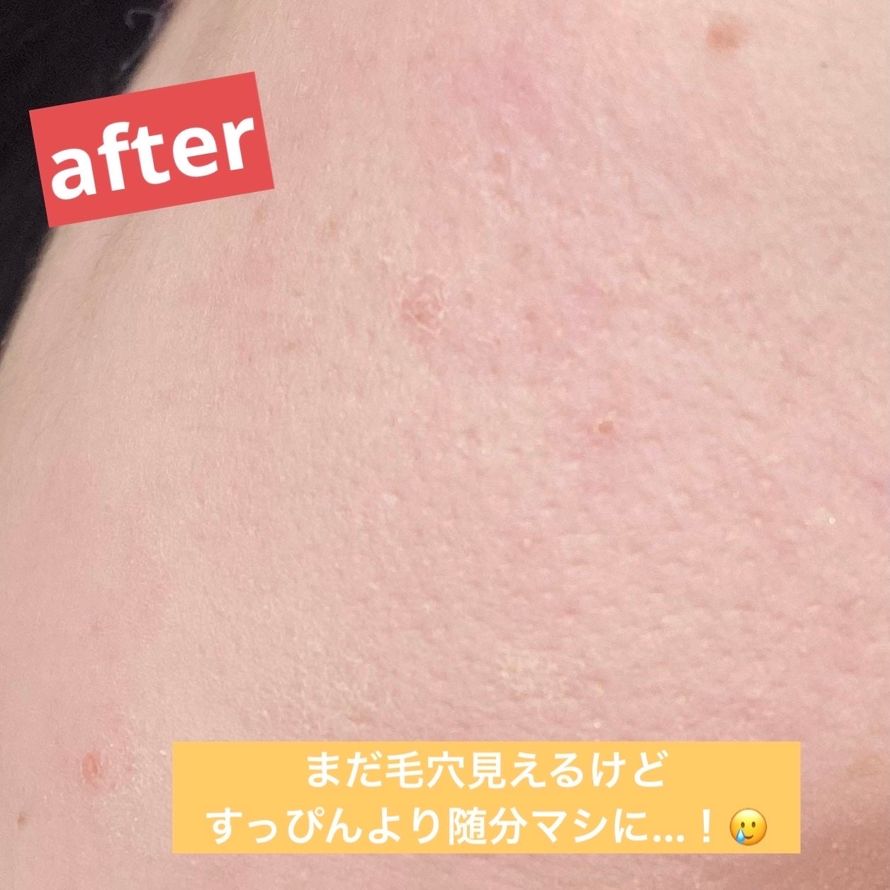 毛穴レスコンシーラー/CEZANNE/クリームコンシーラーを使ったクチコミ(5枚目)