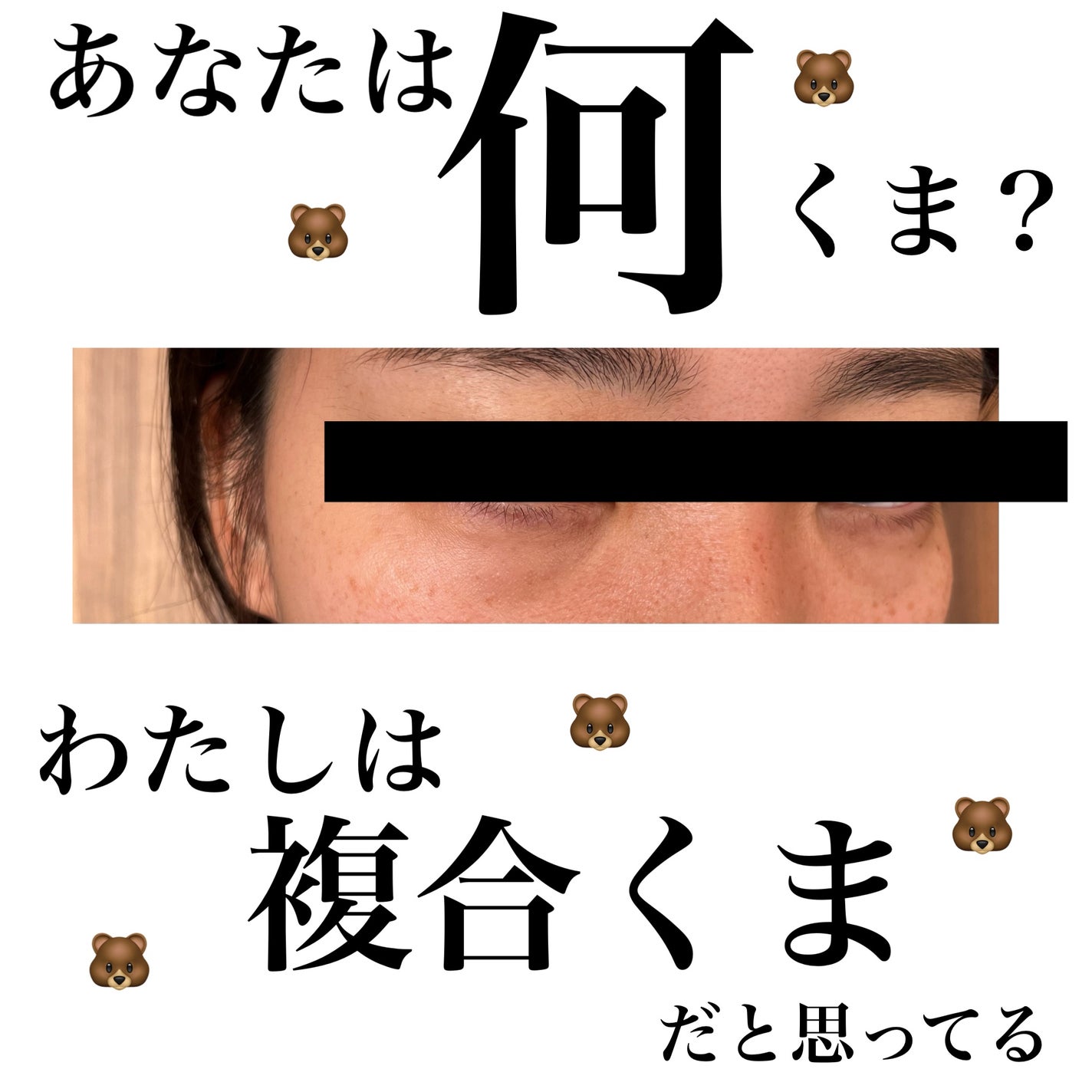 &be ファンシーラー/&be/パレットコンシーラーを使ったクチコミ(1枚目)