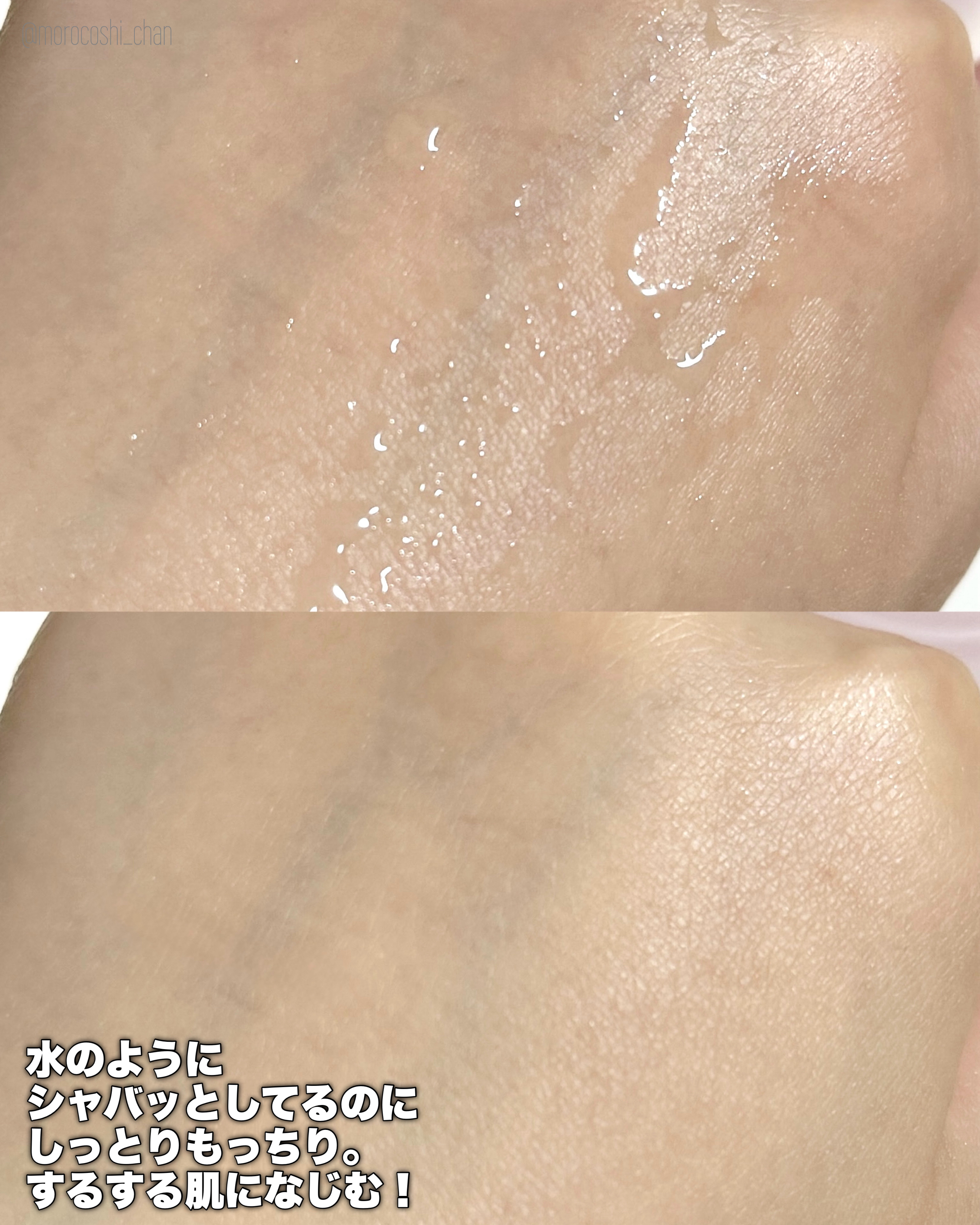 薬用ローション センシティブEX/ドクターシーラボⓇ/化粧水を使ったクチコミ（3枚目）