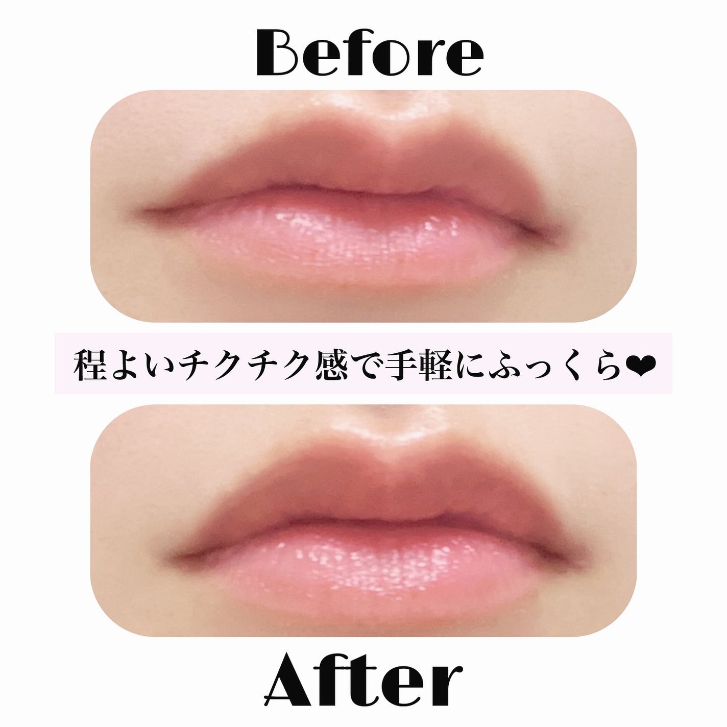 キューミ―ボムショットリッププランパー/AGARISM/リッププランパーを使ったクチコミ(3枚目)