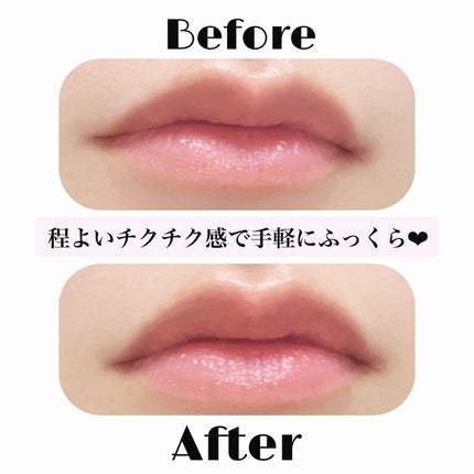 キューミ―ボムショットリッププランパー/AGARISM/リッププランパーを使ったクチコミ(3枚目)