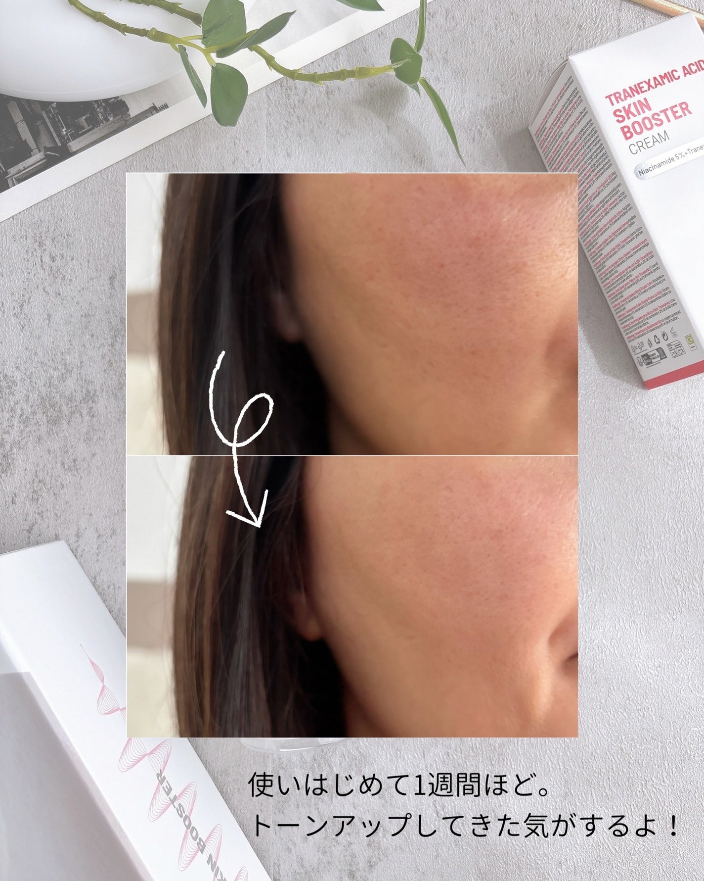 けっぴー♡フォロバ100 on LIPS 「𓆸お家で毎日3分ポテンツァ♡メディテラピー「アルブチンスキ..」(3枚目)