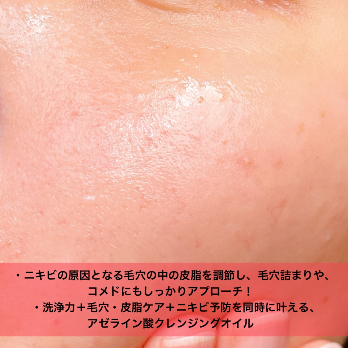 VT AZケア クレンジングオイルのクチコミ「発売３時間で売り切れ🥲💗
唯一無二！やさしく、強い！


❤︎︎︎︎┈┈┈┈┈┈┈┈┈┈┈┈┈.....」（2枚目）