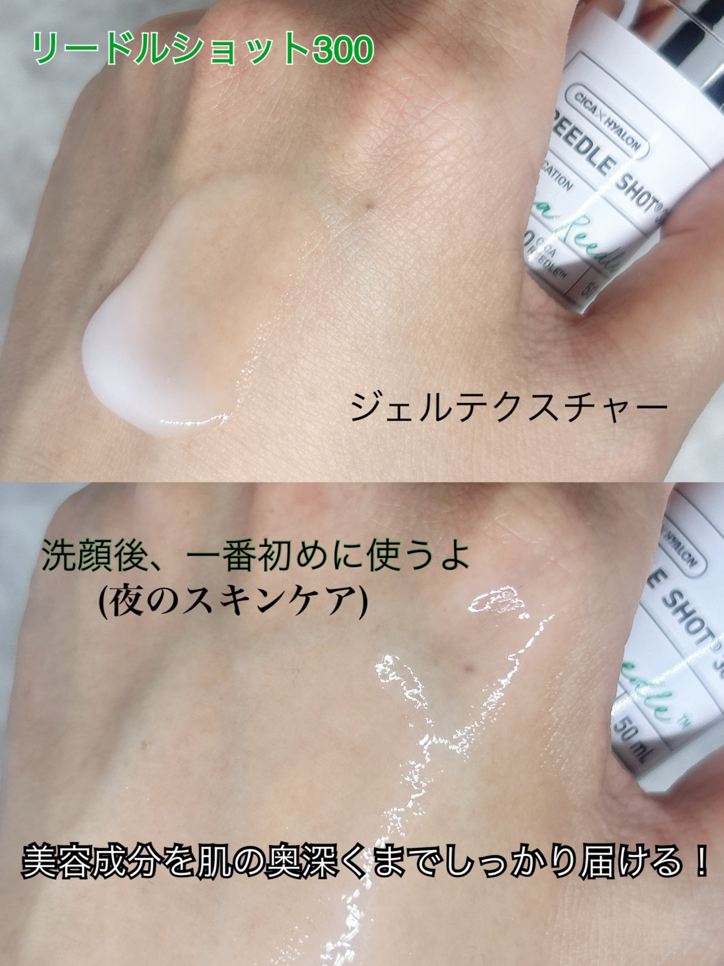 リードルショット300/VT/美容液を使ったクチコミ(2枚目)