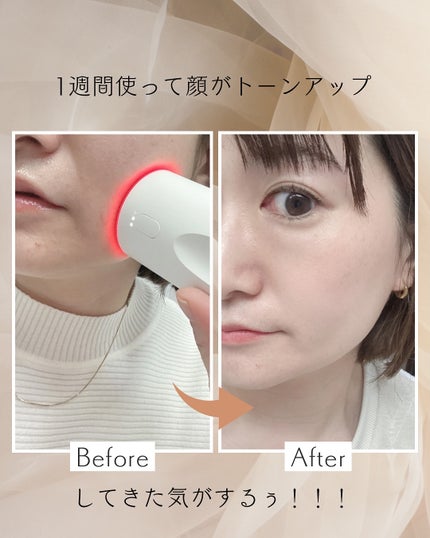 ちゃる♡ on LIPS 「#PR \動画あり/#メディテラピーより新発売🎉・アルブチンス..」(4枚目)