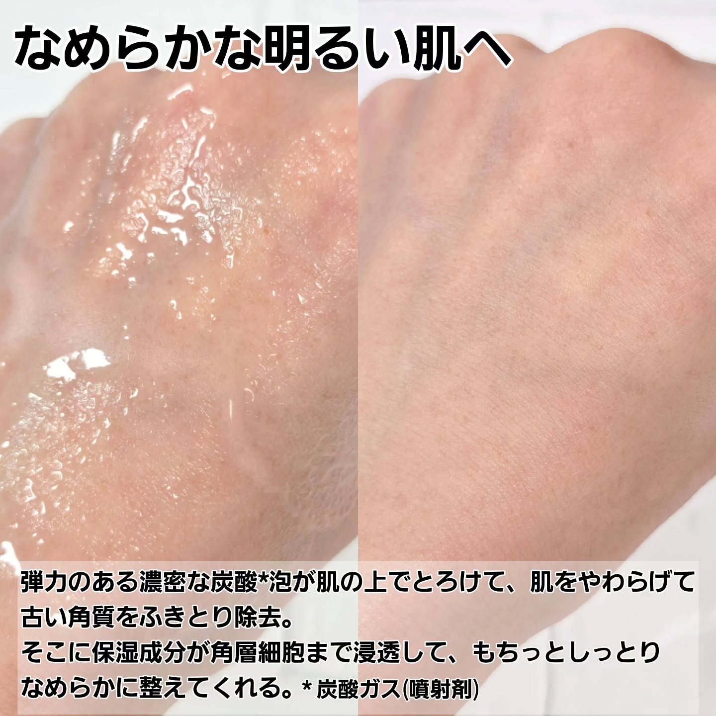 ソフィーナ iP 水光ピーリング泡セラム<ふきとり美容液>/SOFINA iP/美容液を使ったクチコミ（3枚目）