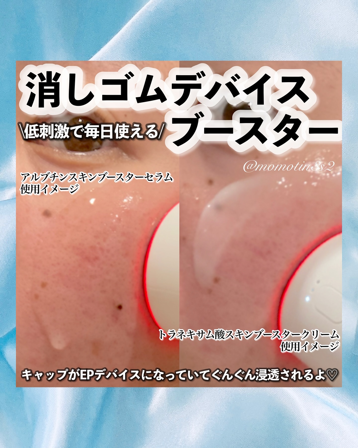 を使ったクチコミ（2枚目）