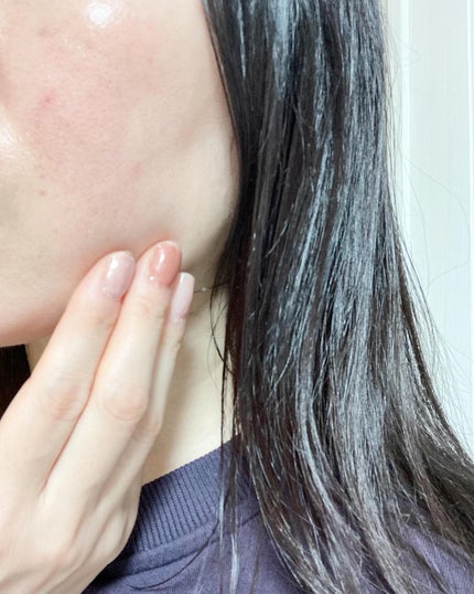 QuSomeホワイト2.0/b.glen/美容液を使ったクチコミ(4枚目)