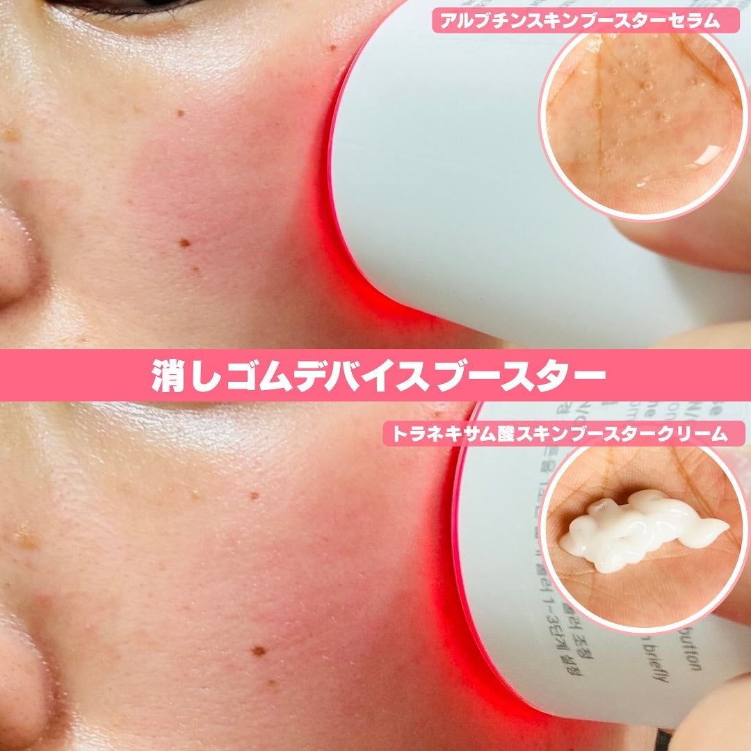 ぽんちんぱん🍞フォロバ100 on LIPS 「#PR#メディテラピー▶︎アルブチンスキンブースターセラム▶︎..」(2枚目)