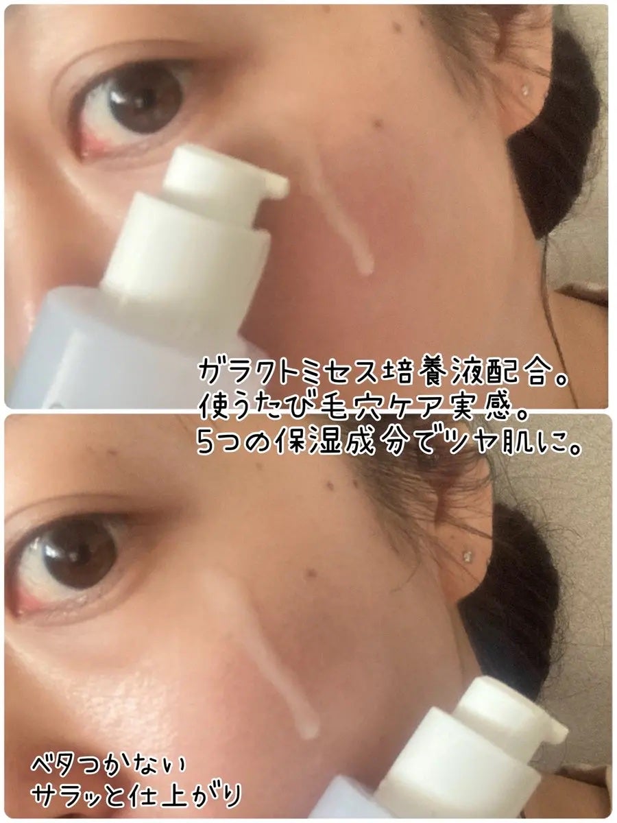 サミュ ガラクトポア セラム/SAM'U/美容液を使ったクチコミ(3枚目)