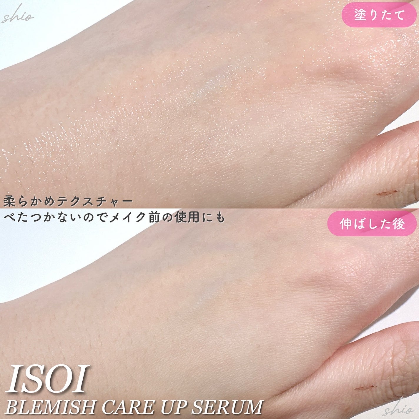 ブレミッシュケアアップ セラム/ISOI/美容液を使ったクチコミ(3枚目)