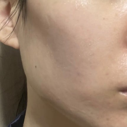 PDRNカフェインショット/IOPE/美容液を使ったクチコミ(3枚目)